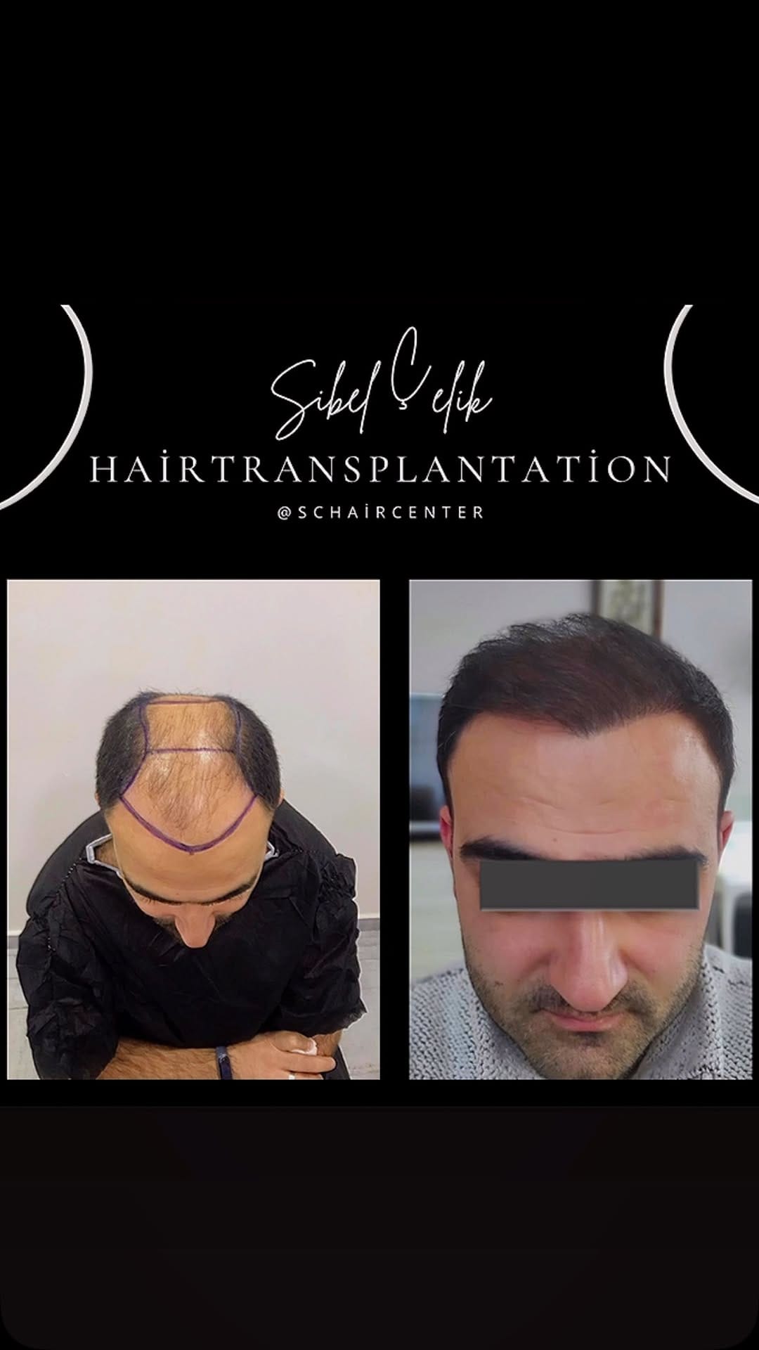 Post 10 by SİBEL ÇELİK on Instagram (video)