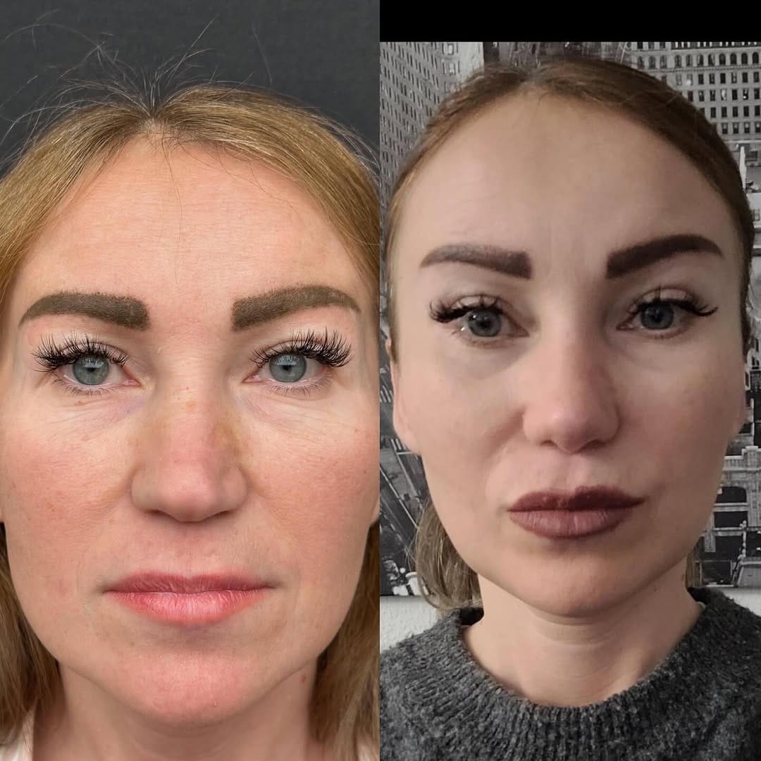 Post 10 by Damla Nihan Özdemir on Instagram (carousel)