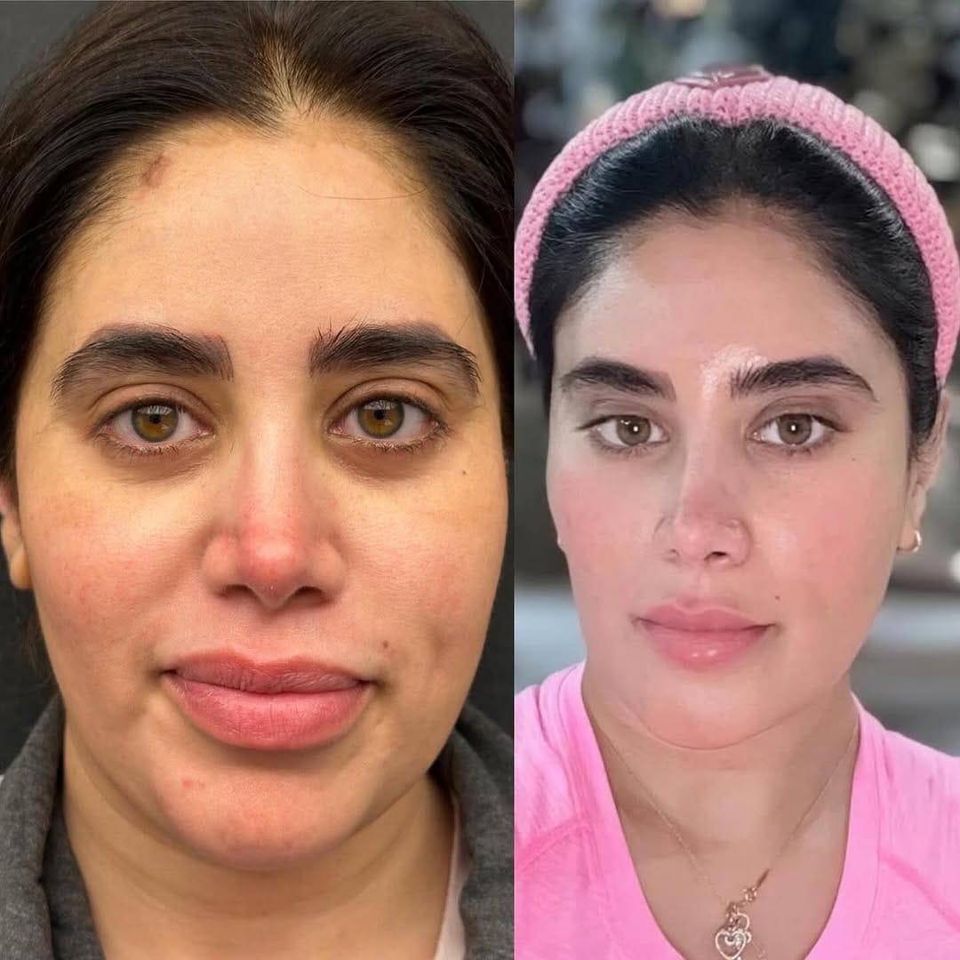 Post 2 by Damla Nihan Özdemir on Instagram (carousel)
