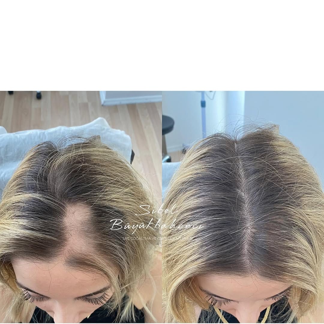 Post 7 by Sibel Büyükbahçeci Maltepe istanbul on Instagram (carousel)