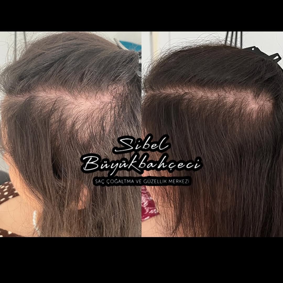 Post 2 by Sibel Büyükbahçeci Maltepe istanbul on Instagram (carousel)