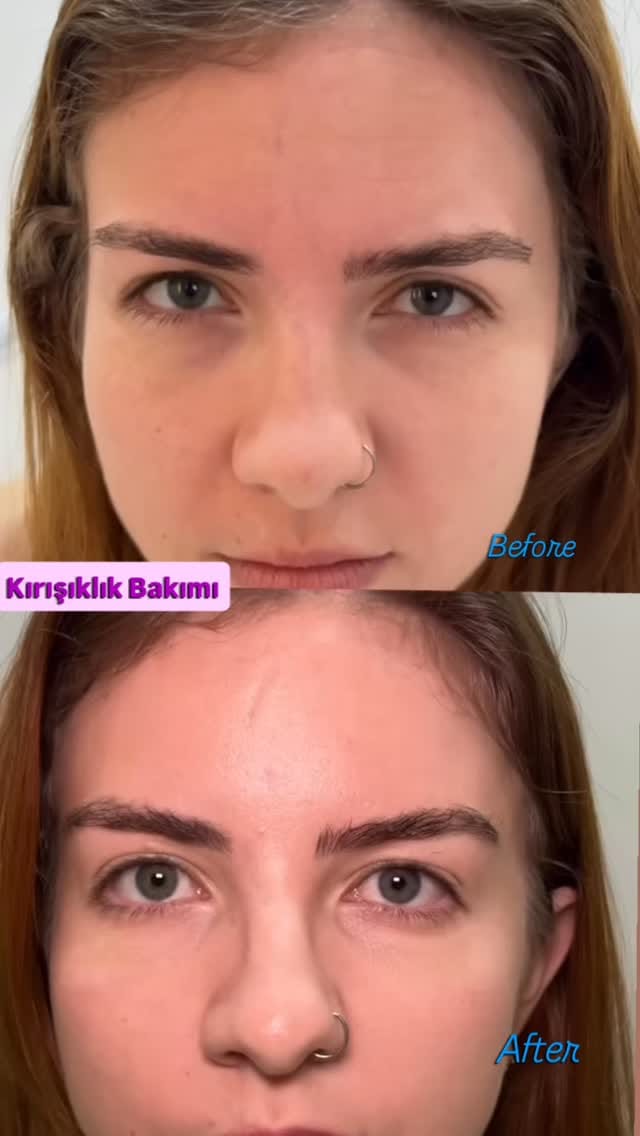 Post 3 by Kübra Çakmak | Kalıcı Makyaj Eğitmeni on Instagram (video)
