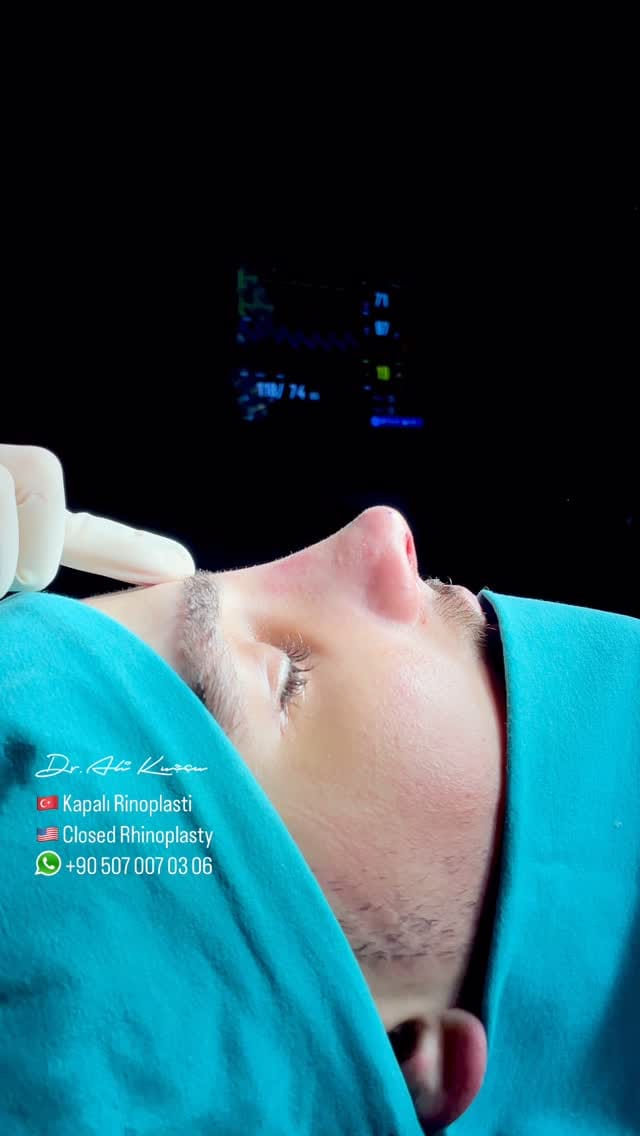 Post 9 by Op. Dr. Ali KUŞÇU (Ali QUSHCHI) on Instagram (video)