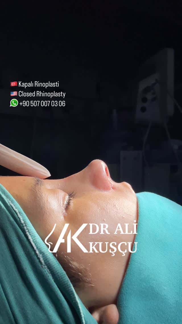 Post 1 by Op. Dr. Ali KUŞÇU (Ali QUSHCHI) on Instagram (video)