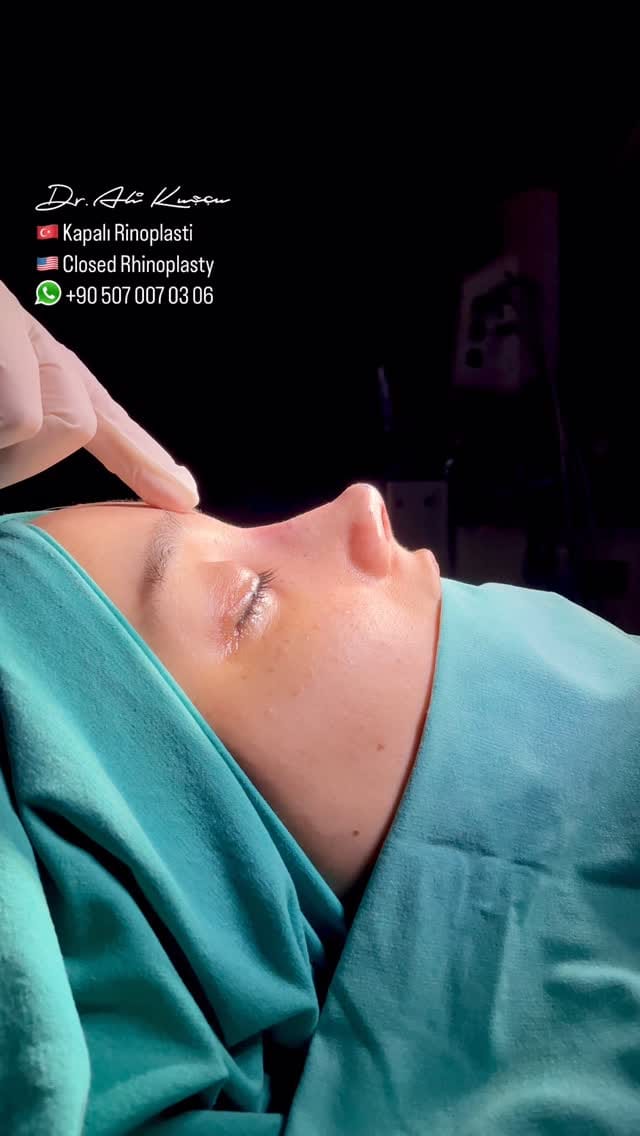 Post 7 by Op. Dr. Ali KUŞÇU (Ali QUSHCHI) on Instagram (video)
