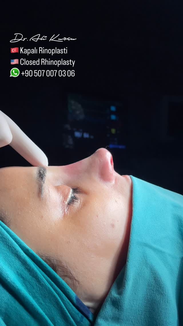 Post 10 by Op. Dr. Ali KUŞÇU (Ali QUSHCHI) on Instagram (video)