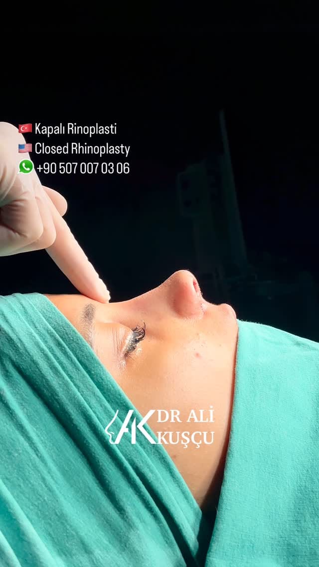 Post 3 by Op. Dr. Ali KUŞÇU (Ali QUSHCHI) on Instagram (video)