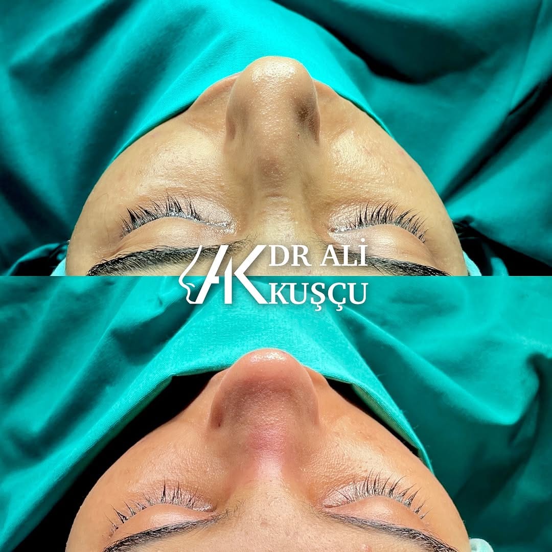 Post 4 by Op. Dr. Ali KUŞÇU (Ali QUSHCHI) on Instagram (carousel)