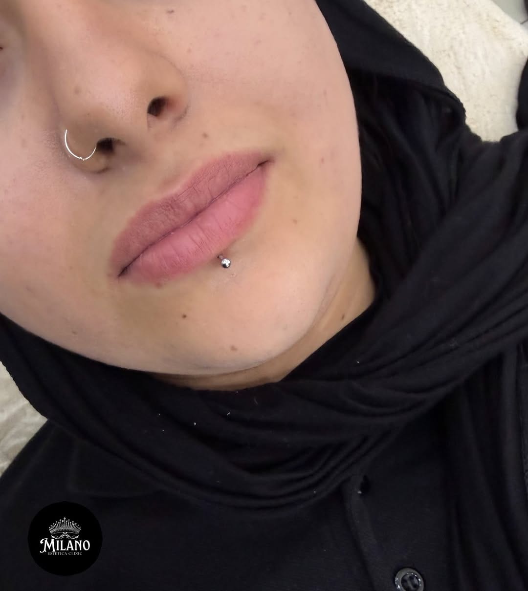 Post 8 by Bakırköy Milano Estetica Clinic on Instagram (carousel)