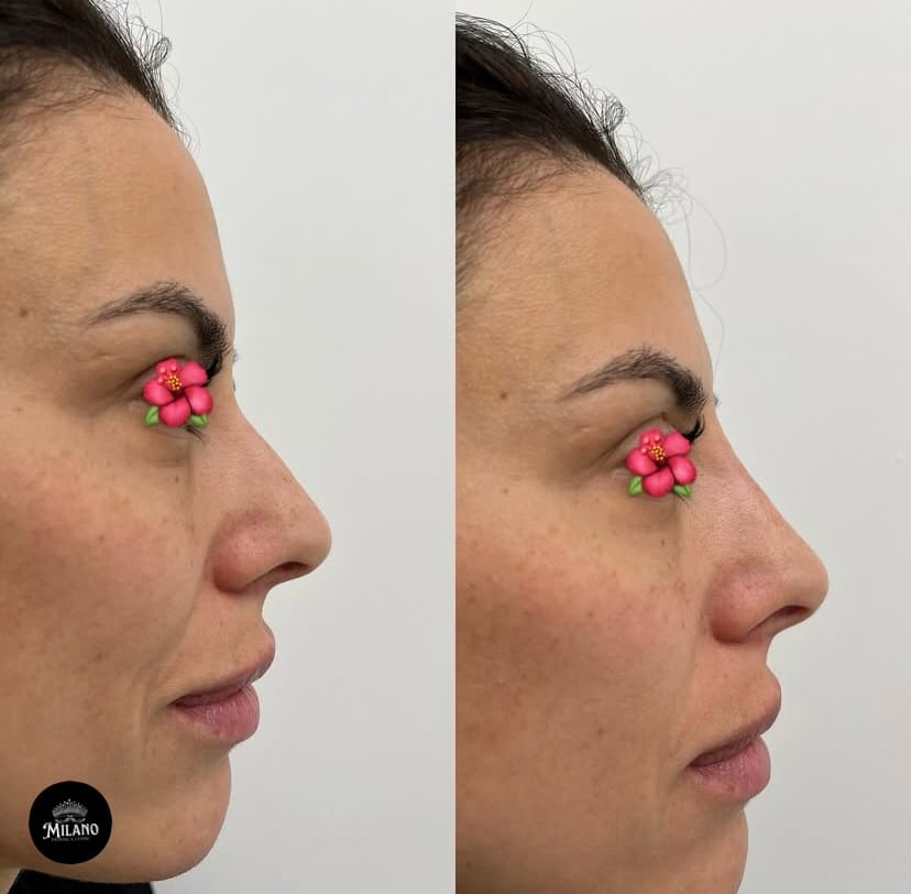 Post 3 by Bakırköy Milano Estetica Clinic on Instagram (image)