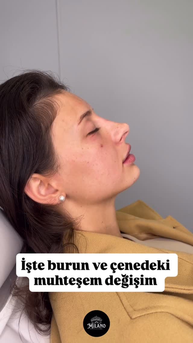 Post 10 by Bakırköy Milano Estetica Clinic on Instagram (video)