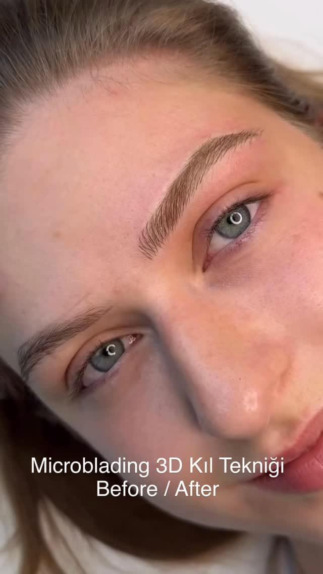 Post 4 by 𝐊ü𝐛𝐫𝐚 𝐀𝐤𝐚𝐭𝐚𝐲 𝐁𝐞𝐚𝐮𝐭𝐲 𝐀𝐞𝐬𝐭𝐡𝐞𝐭𝐢𝐜 𝐕𝐢𝐩 𝐂𝐞𝐧𝐭𝐞𝐫 on Instagram (video)