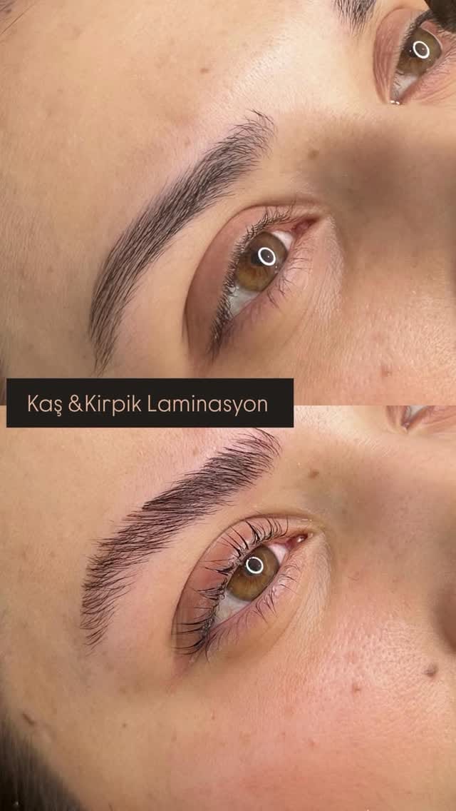 Post 6 by Ümit Açıkgöz Güzellik Merkezi on Instagram (video)