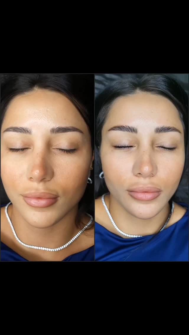 Post 5 by OCHI BEAUTY STUDIO on Instagram (video)