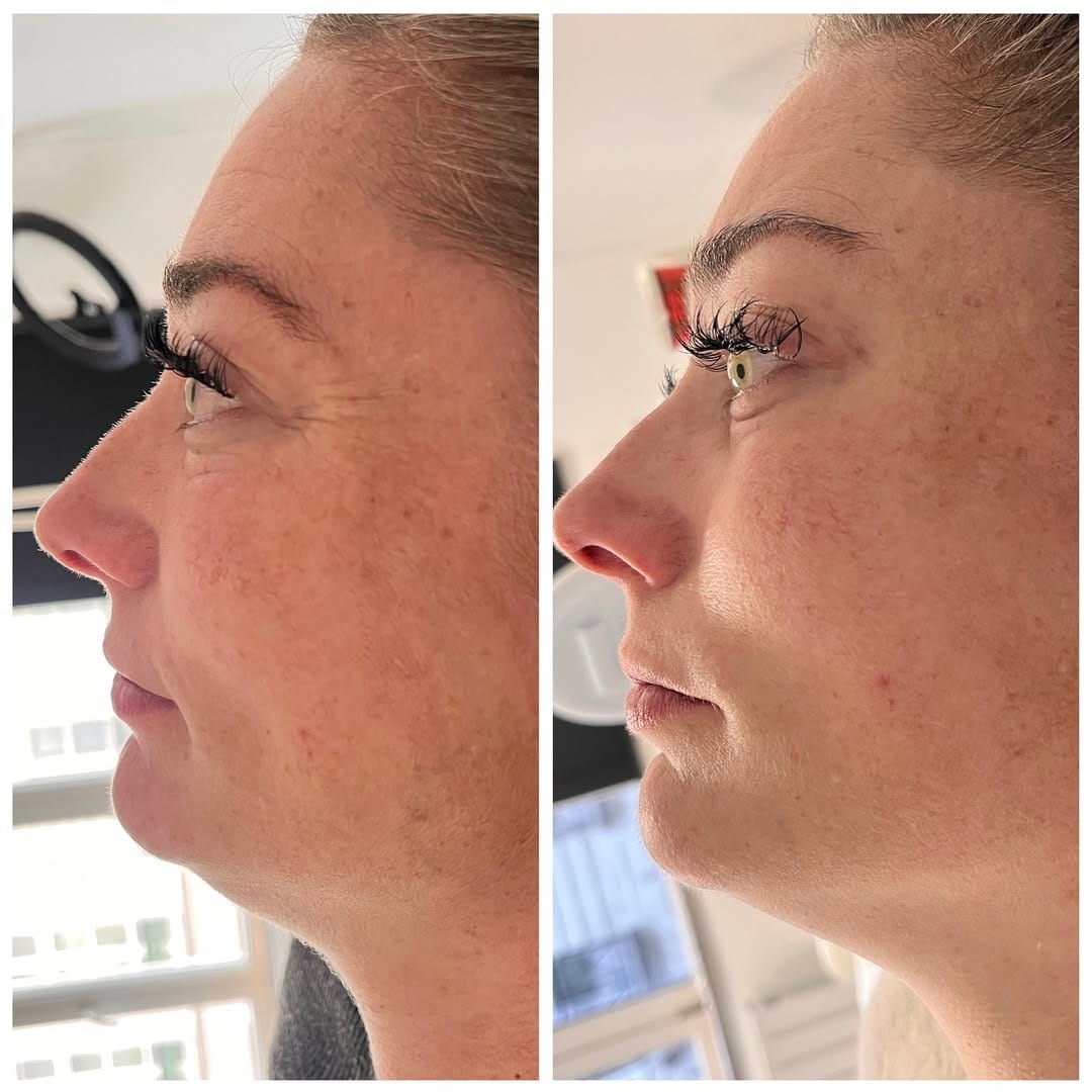 Post 3 by Formation extensions de cils Lille on Instagram (carousel)