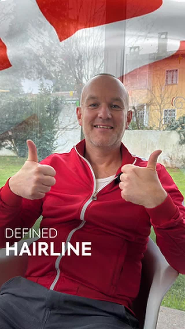 Post 1 by MCAN Health | Hair Transplant on Instagram (video)