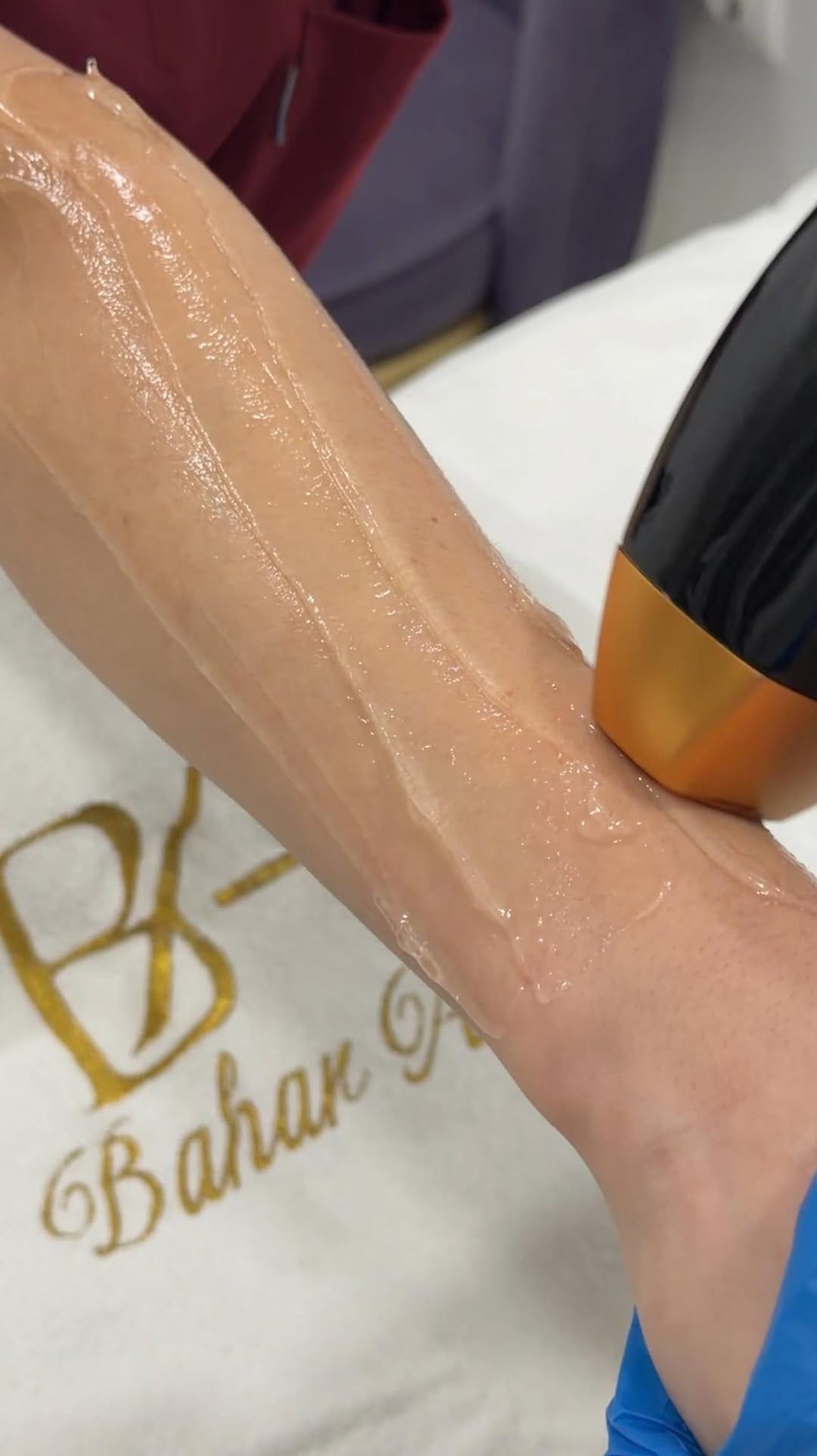 Post 6 by Bahar Acar on Instagram (video)
