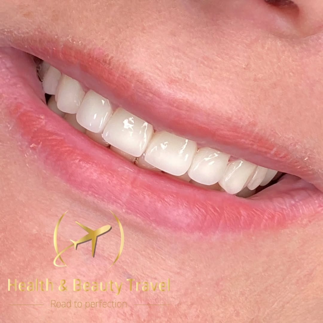 Post 1 by Health & Beauty Travel Dent on Instagram (image)