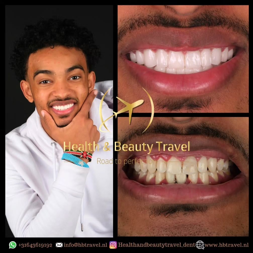 Post 9 by Health & Beauty Travel Dent on Instagram (image)