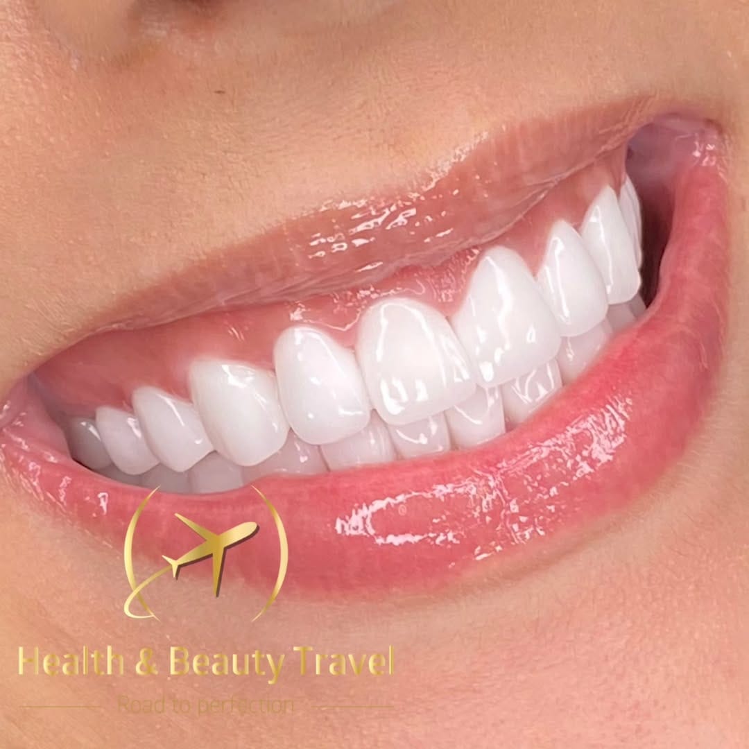 Post 4 by Health & Beauty Travel Dent on Instagram (image)