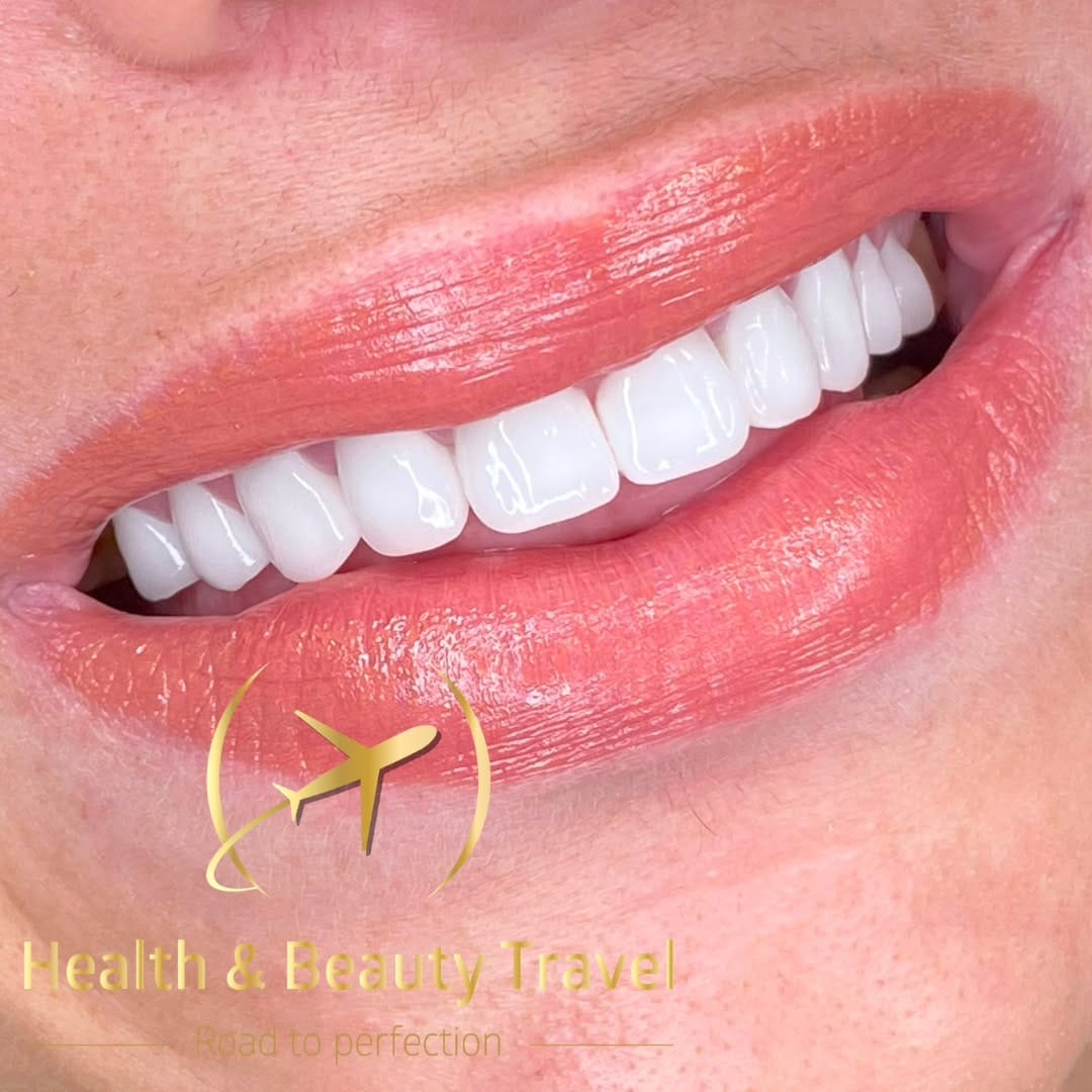 Post 10 by Health & Beauty Travel Dent on Instagram (image)