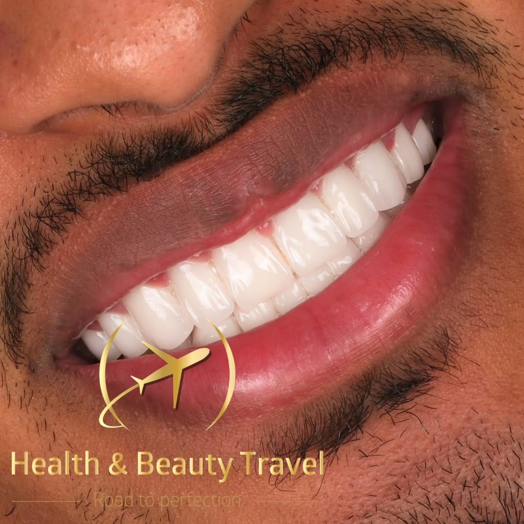 Post 7 by Health & Beauty Travel Dent on Instagram (carousel)