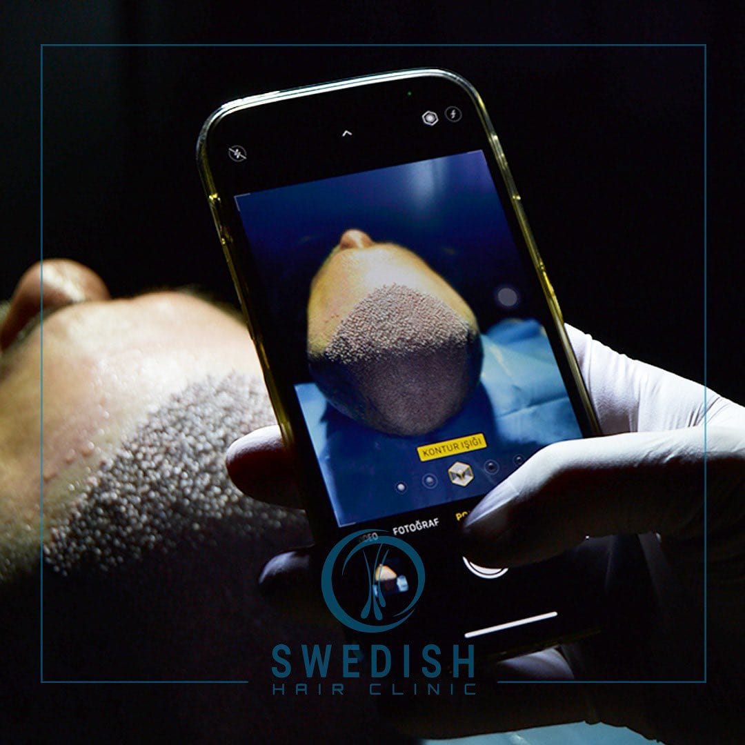 Post 2 by Swedish Hair Clinic on Instagram (image)