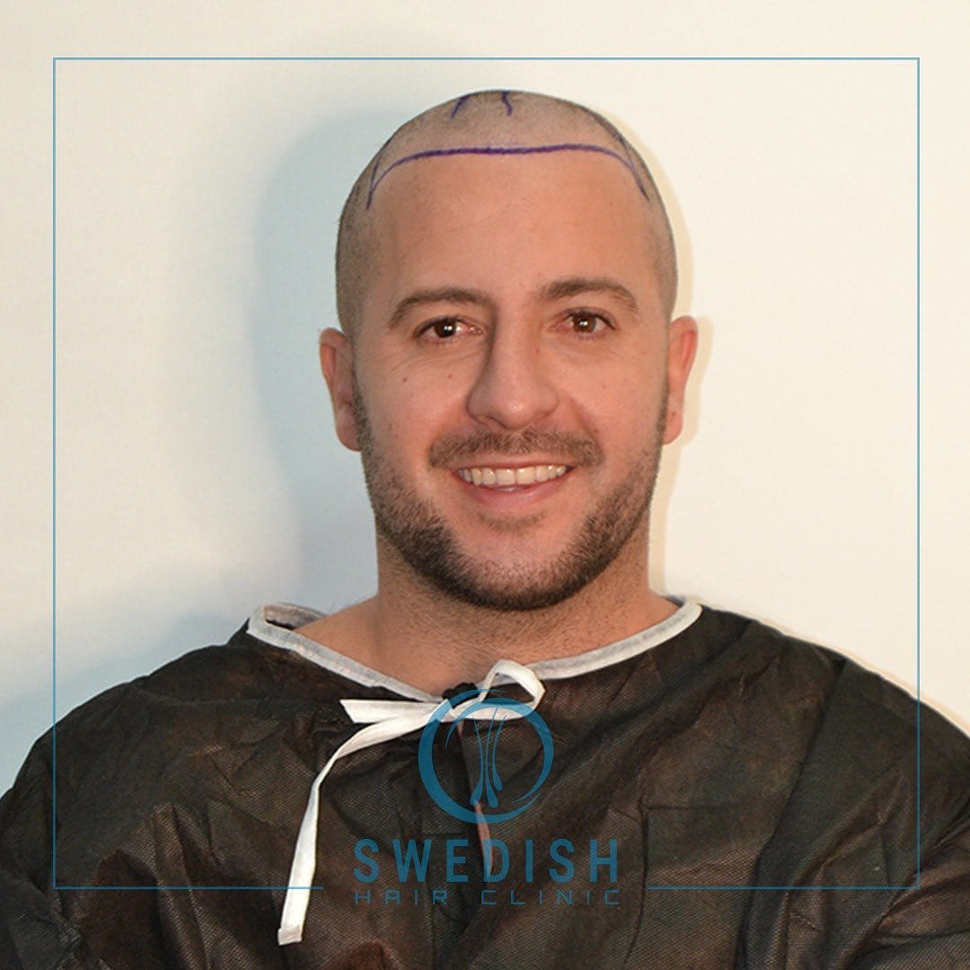 Post 9 by Swedish Hair Clinic on Instagram (carousel)