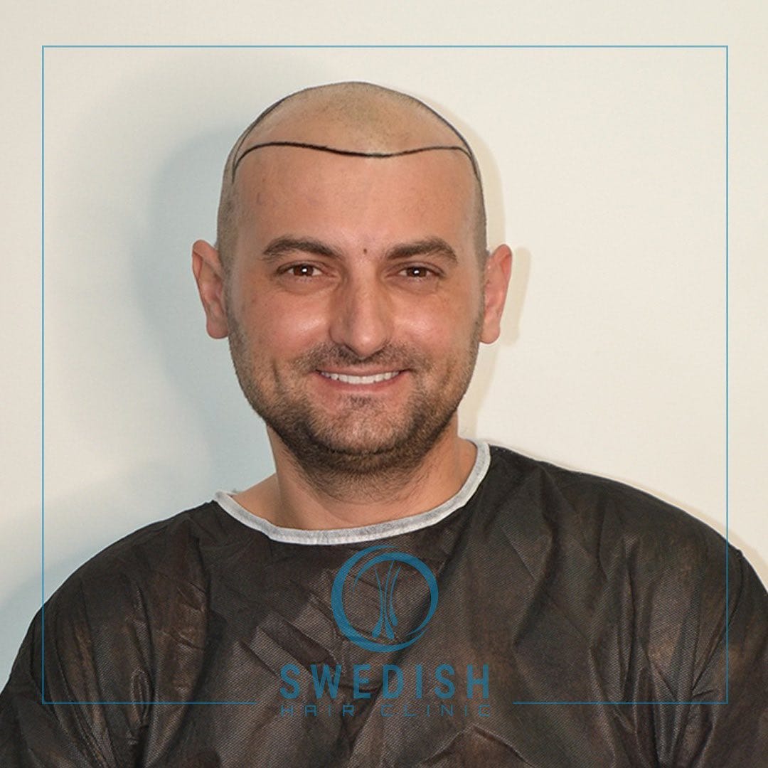 Post 3 by Swedish Hair Clinic on Instagram (carousel)