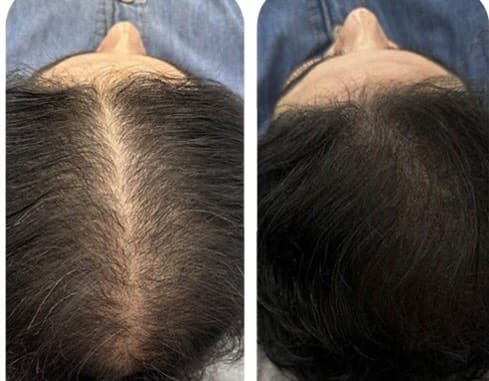 Post 9 by Selin Beauty Center Bakırköy on Instagram (image)