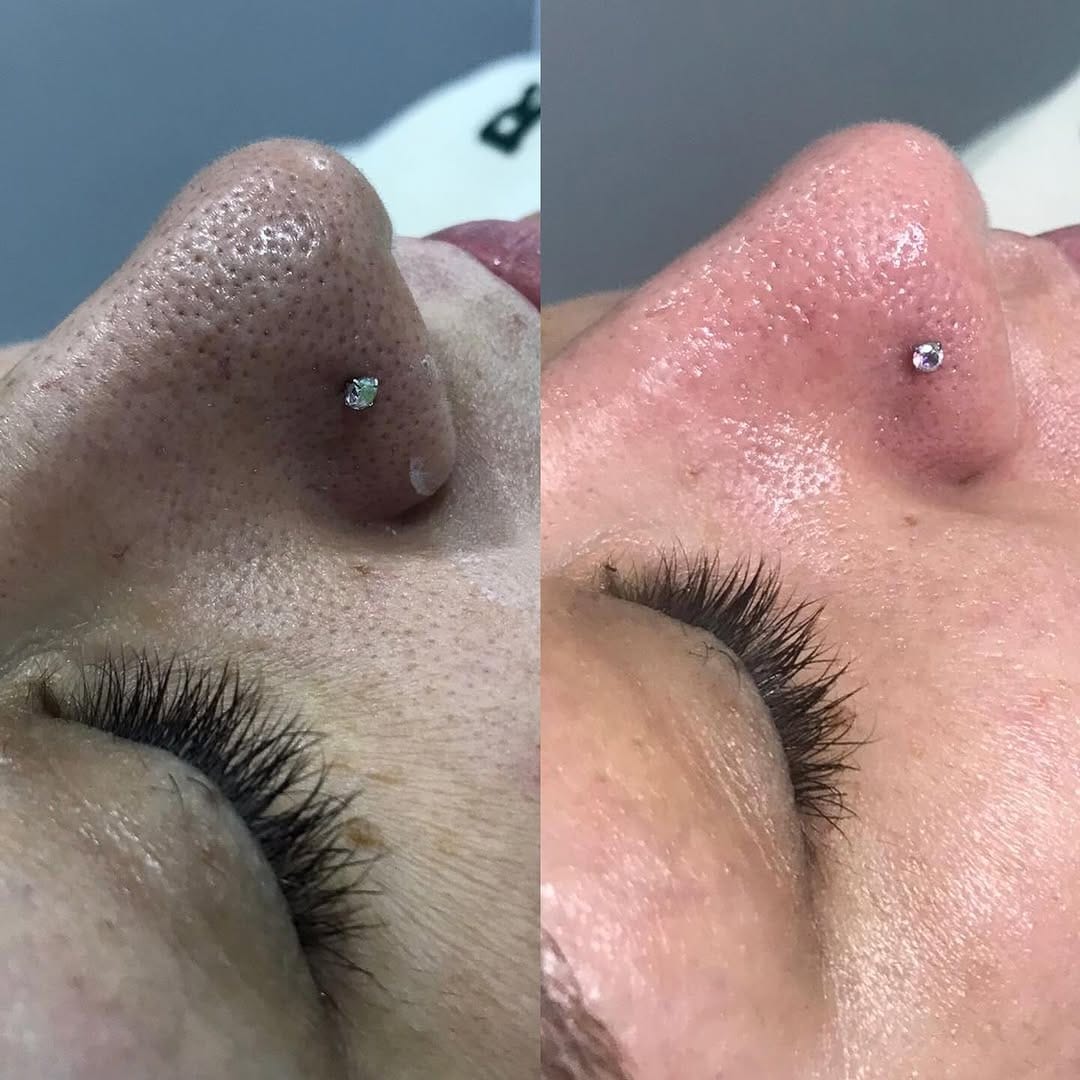 Post 2 by Selin Beauty Center Bakırköy on Instagram (image)