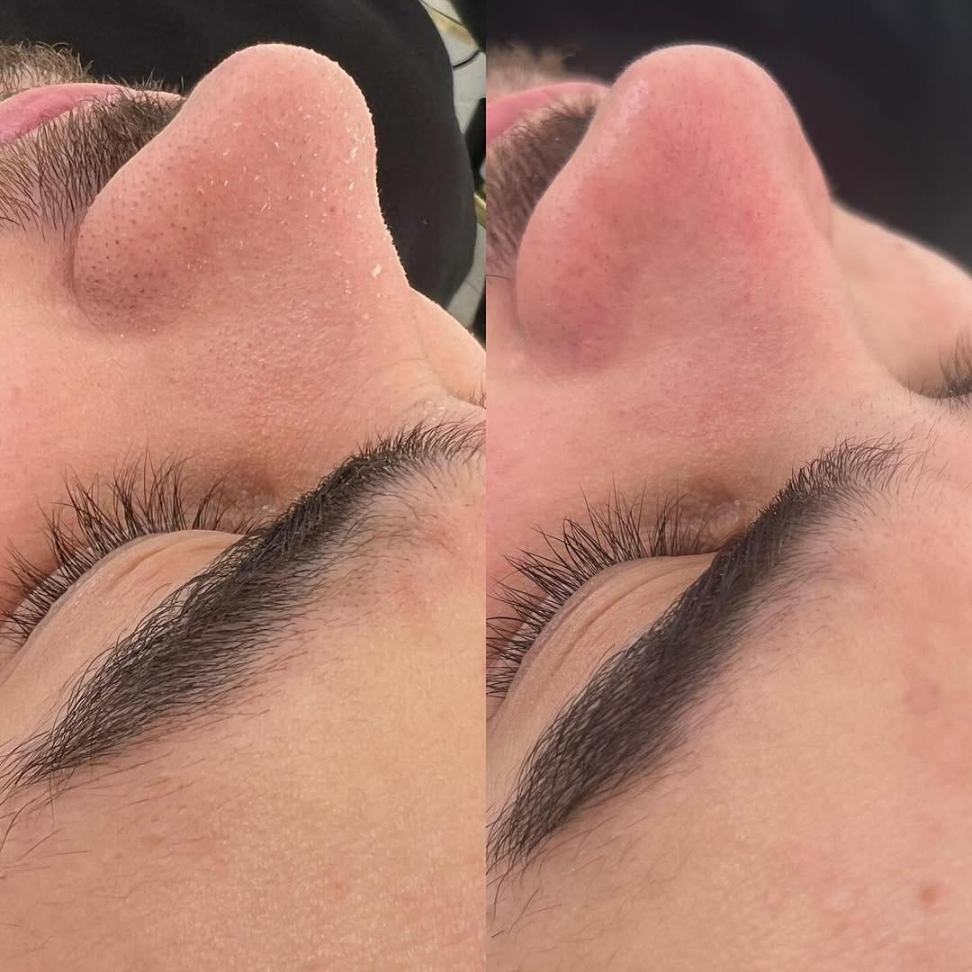 Post 10 by Selin Beauty Center Bakırköy on Instagram (image)