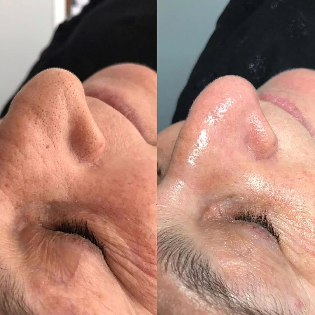 Post 4 by Selin Beauty Center Bakırköy on Instagram (image)