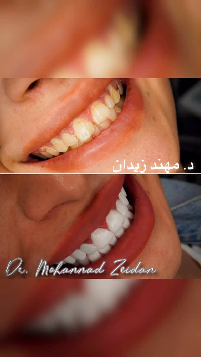 Post 2 by Dr.Mohannad Zeidan on Instagram (video)