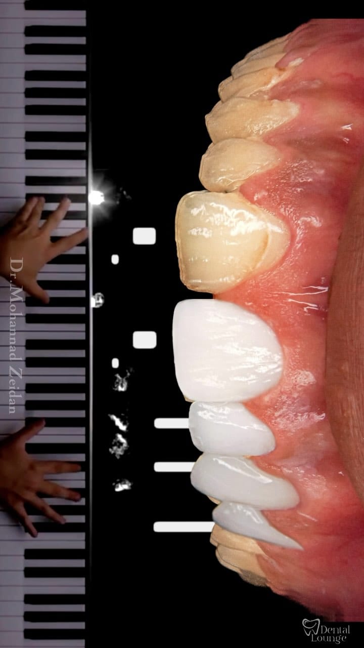Post 6 by Dr.Mohannad Zeidan on Instagram (video)
