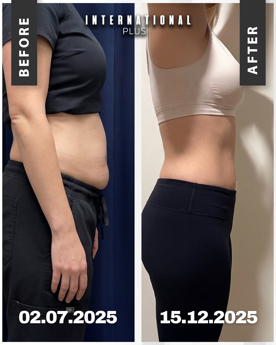 Post 7 by Plastic Surgery Istanbul on Instagram (image)