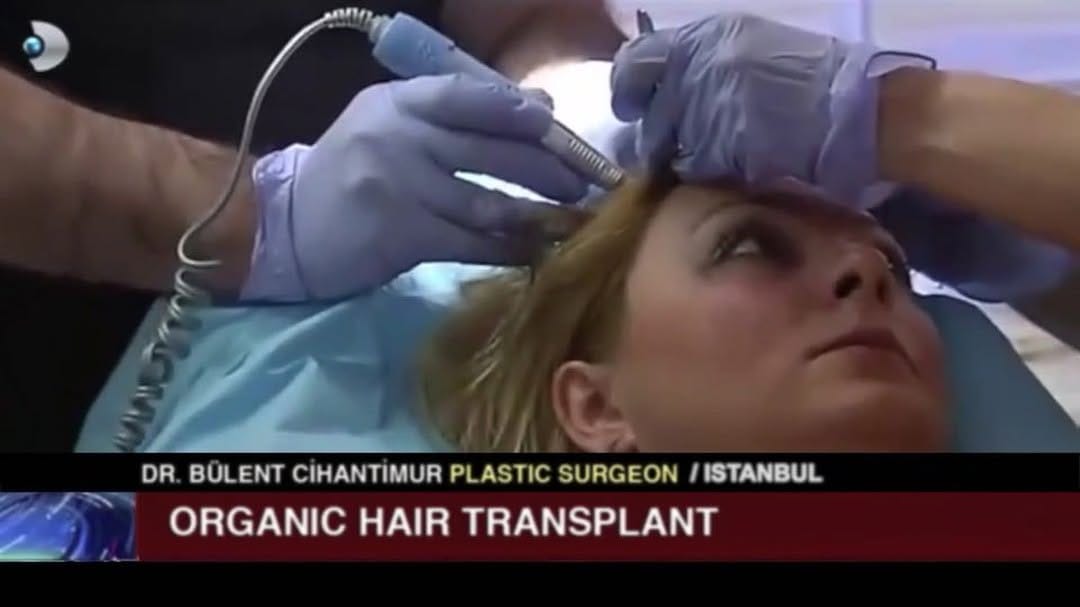 Post 5 by Estetik International on Instagram (video)
