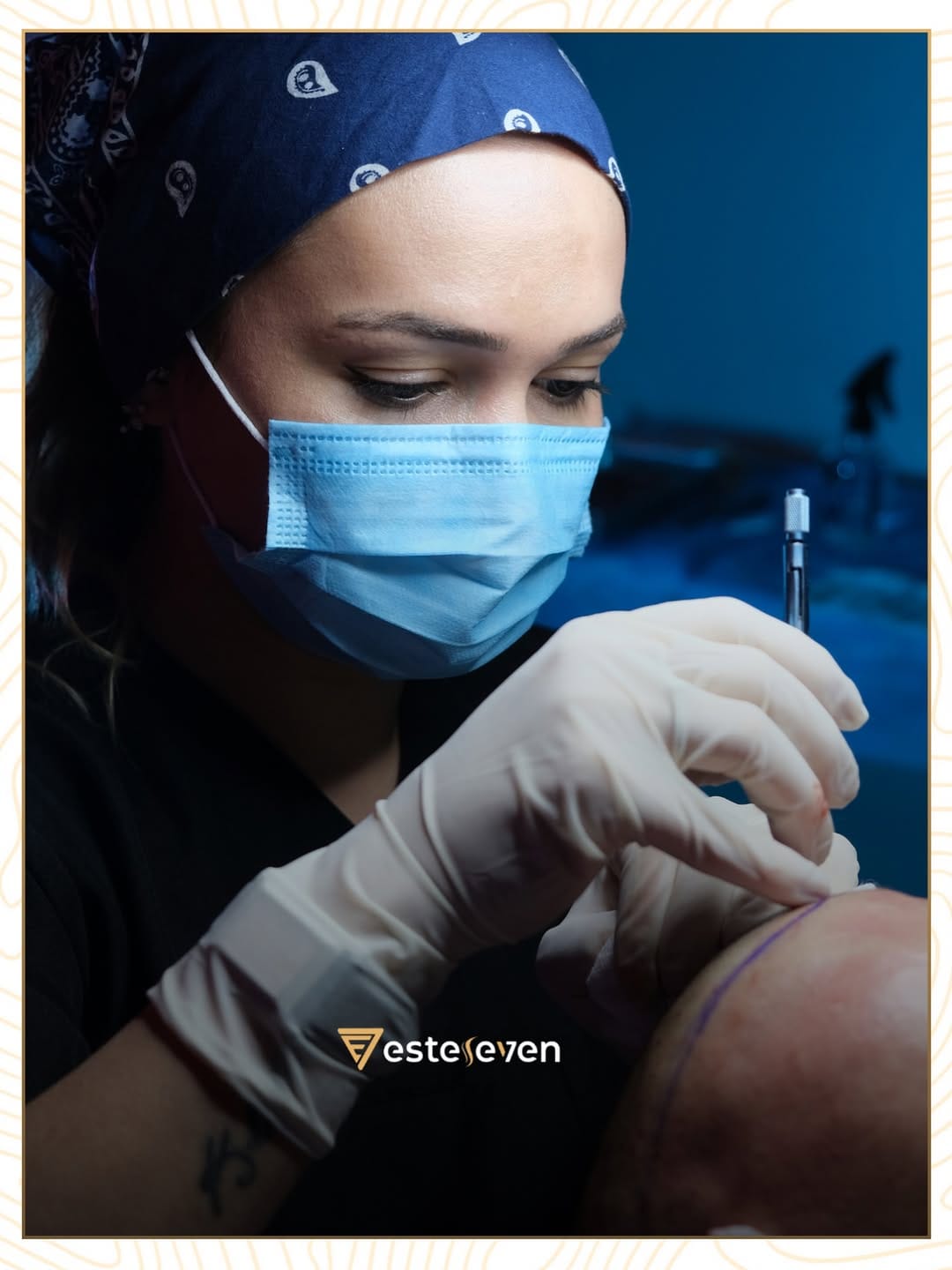 Post 10 by Esteseven Hair Transplant on Instagram (image)