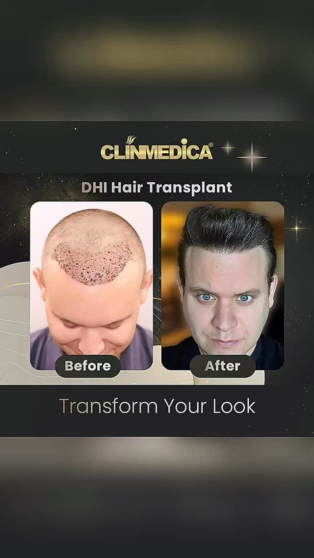 Post 2 by ClinMedica on Instagram (video)