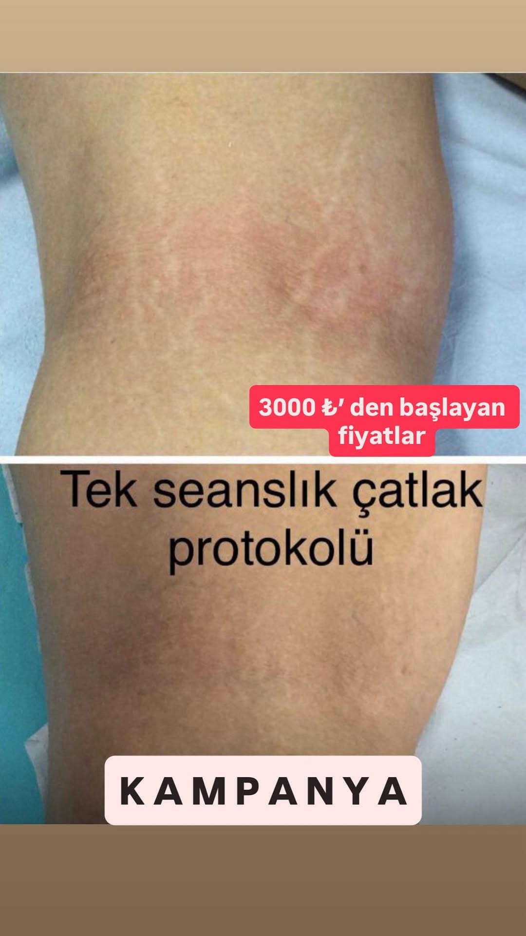 Post 9 by 𝐙𝐞𝐲𝐧𝐞𝐩 𝐀𝐥𝐚𝐲 𝐁𝐞𝐚𝐮𝐭𝐲 on Instagram (video)