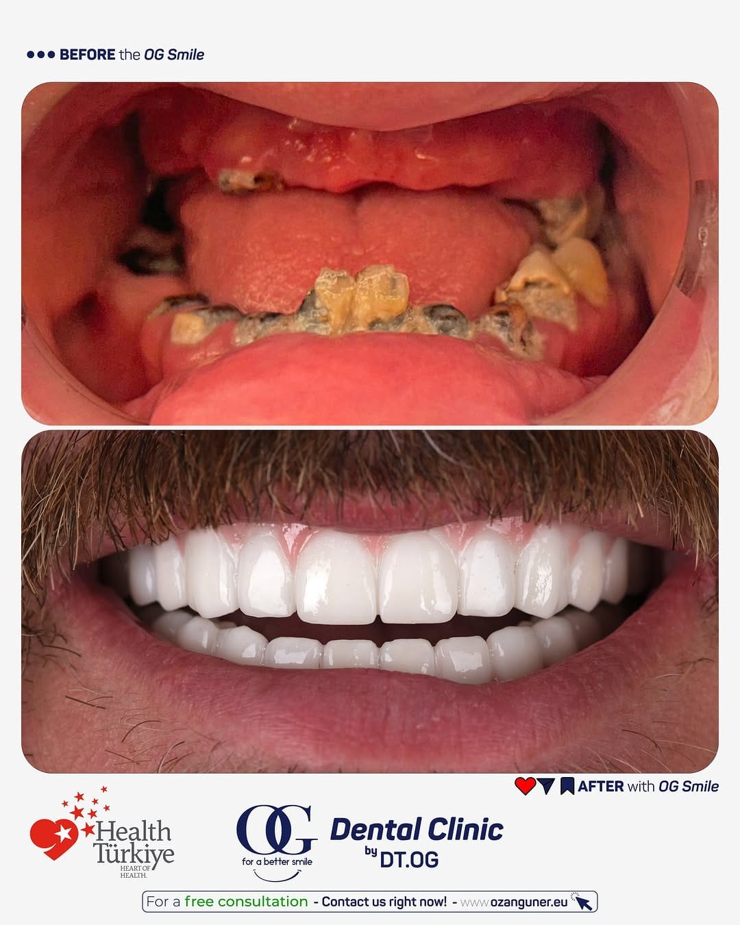 Post 7 by OG Dental Clinic International on Instagram (carousel)