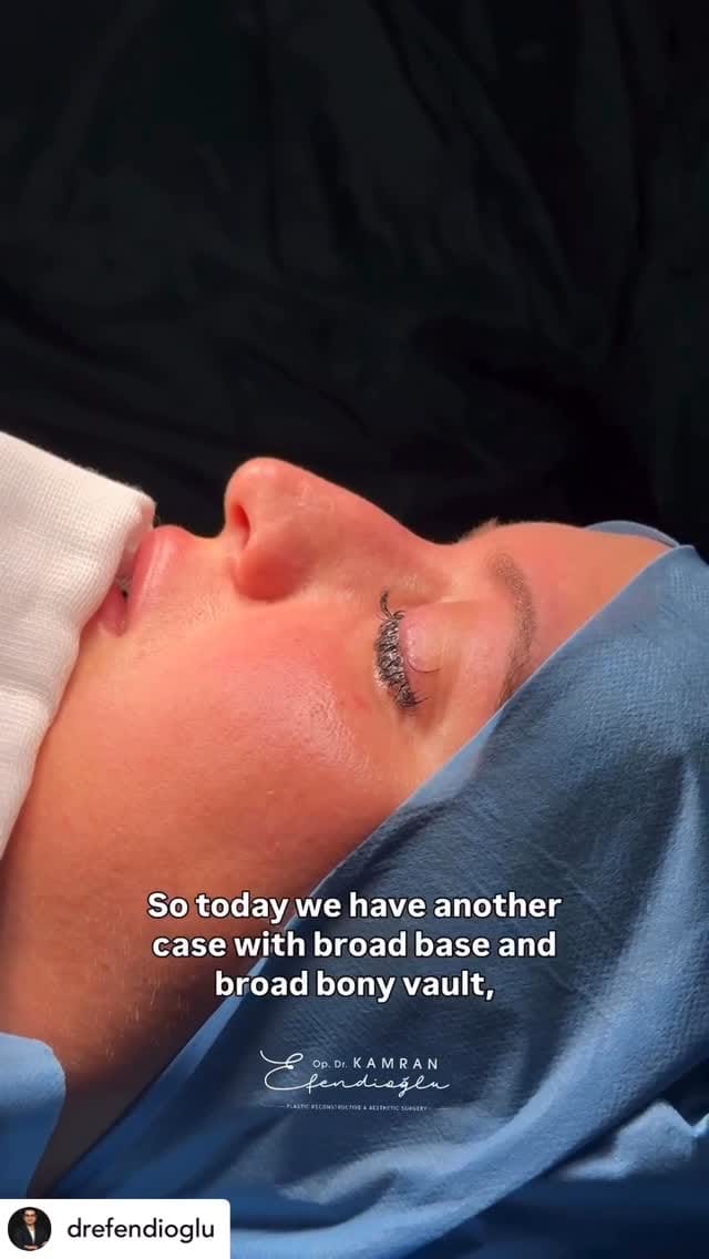 Post 4 by BeautyTrips on Instagram (video)
