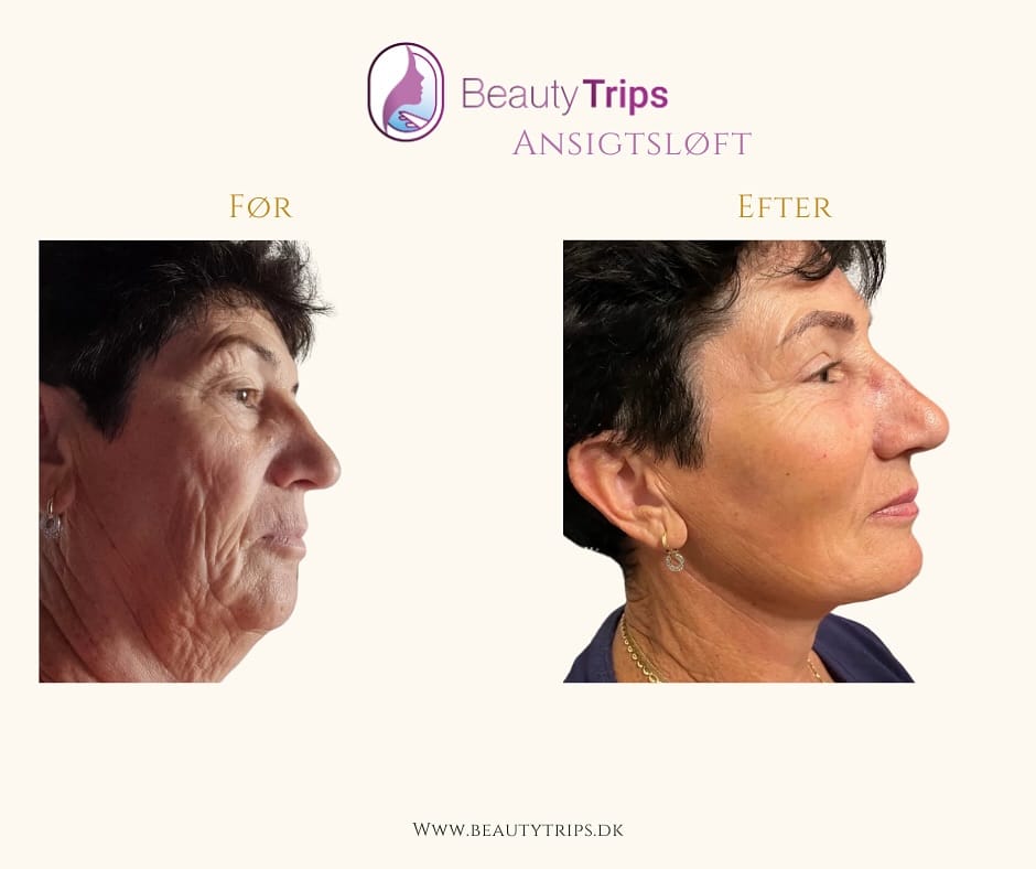 Post 8 by BeautyTrips on Instagram (image)