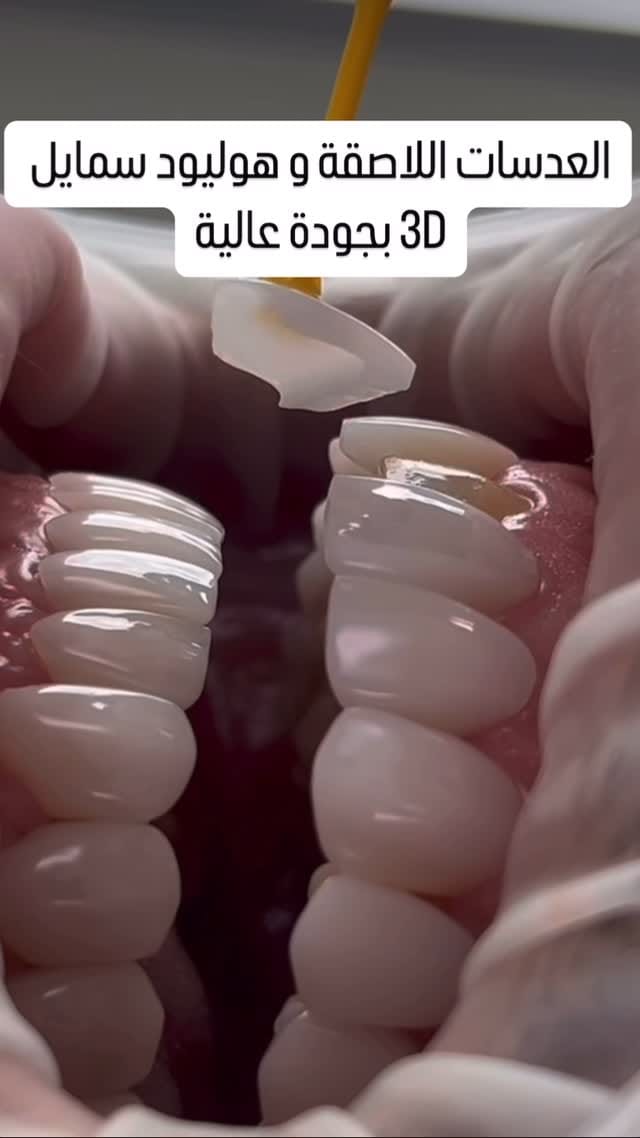 Post 6 by Mounir Elhouari on Instagram (video)