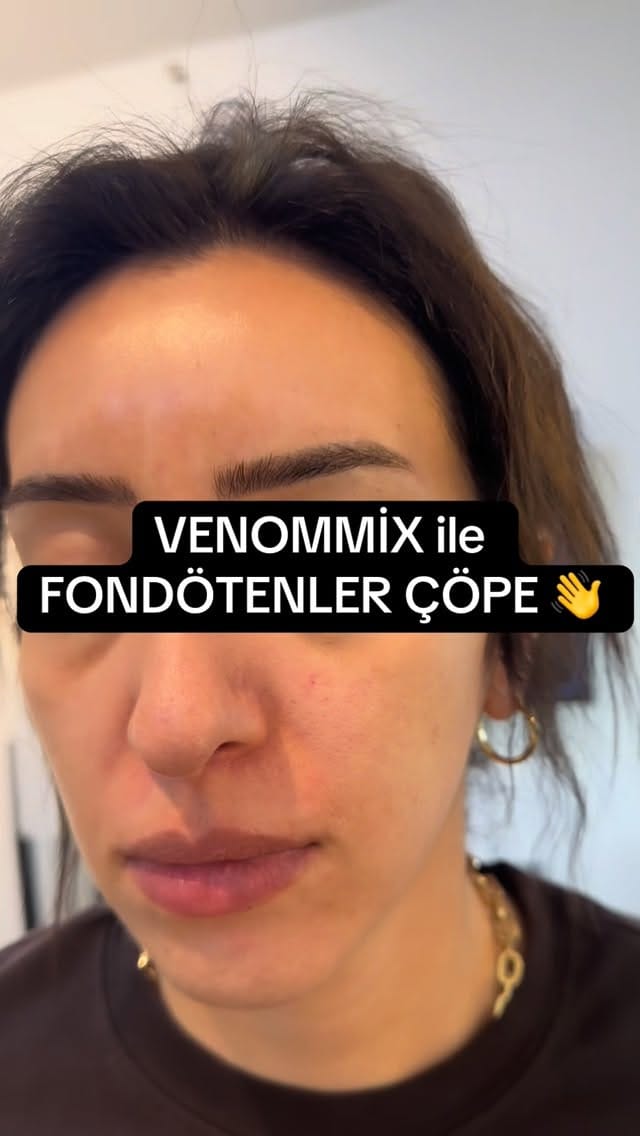 Post 6 by Venomguzellikk on Instagram (video)