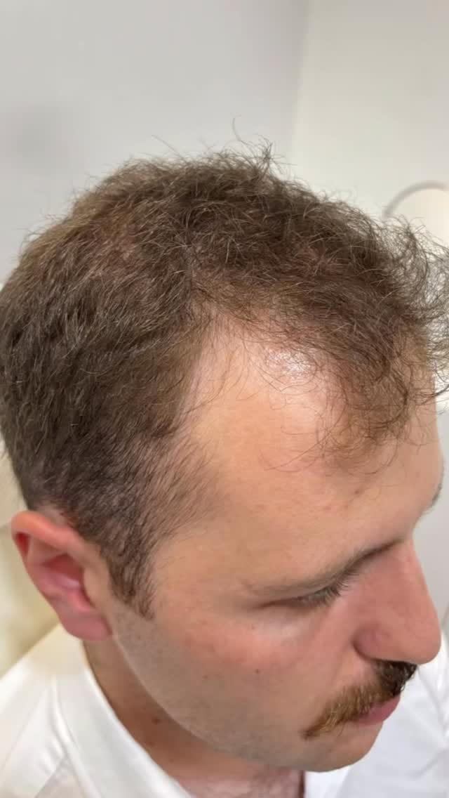 Post 2 by PRO WELLNESS on Instagram (video)