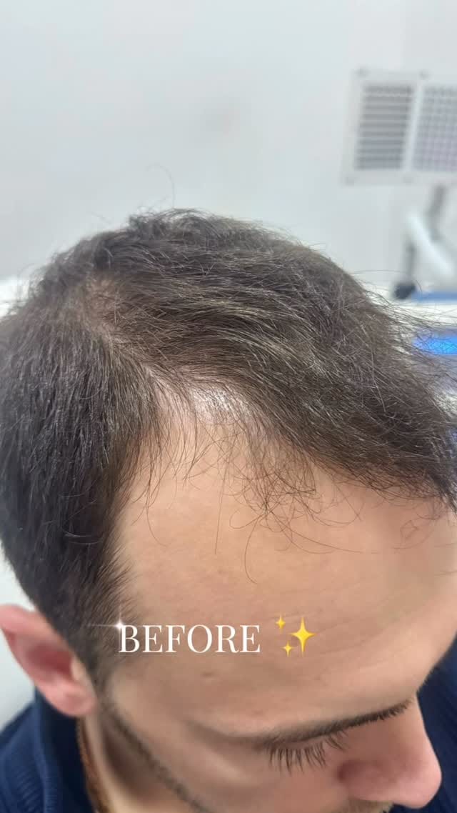 Post 5 by PRO WELLNESS on Instagram (video)