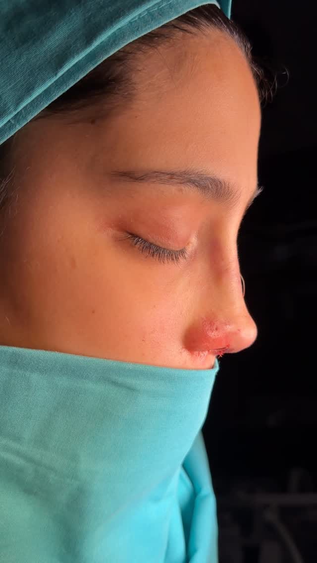 Post 1 by Dr Bahadır Baykal on Instagram (video)
