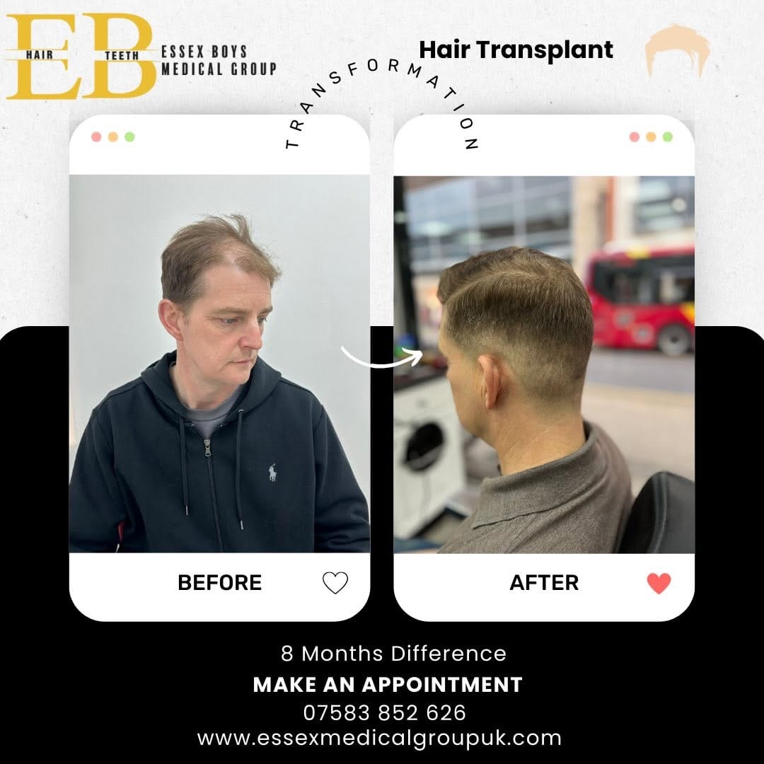 Post 1 by Essex Boys Medical Group on Instagram (image)