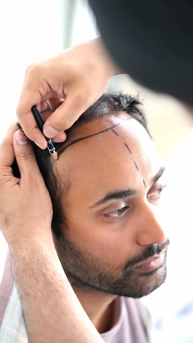 Post 4 by DR.ART CLINIC on Instagram (video)